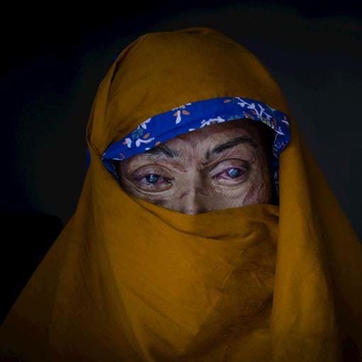 Acid Survivors Foundation Cover